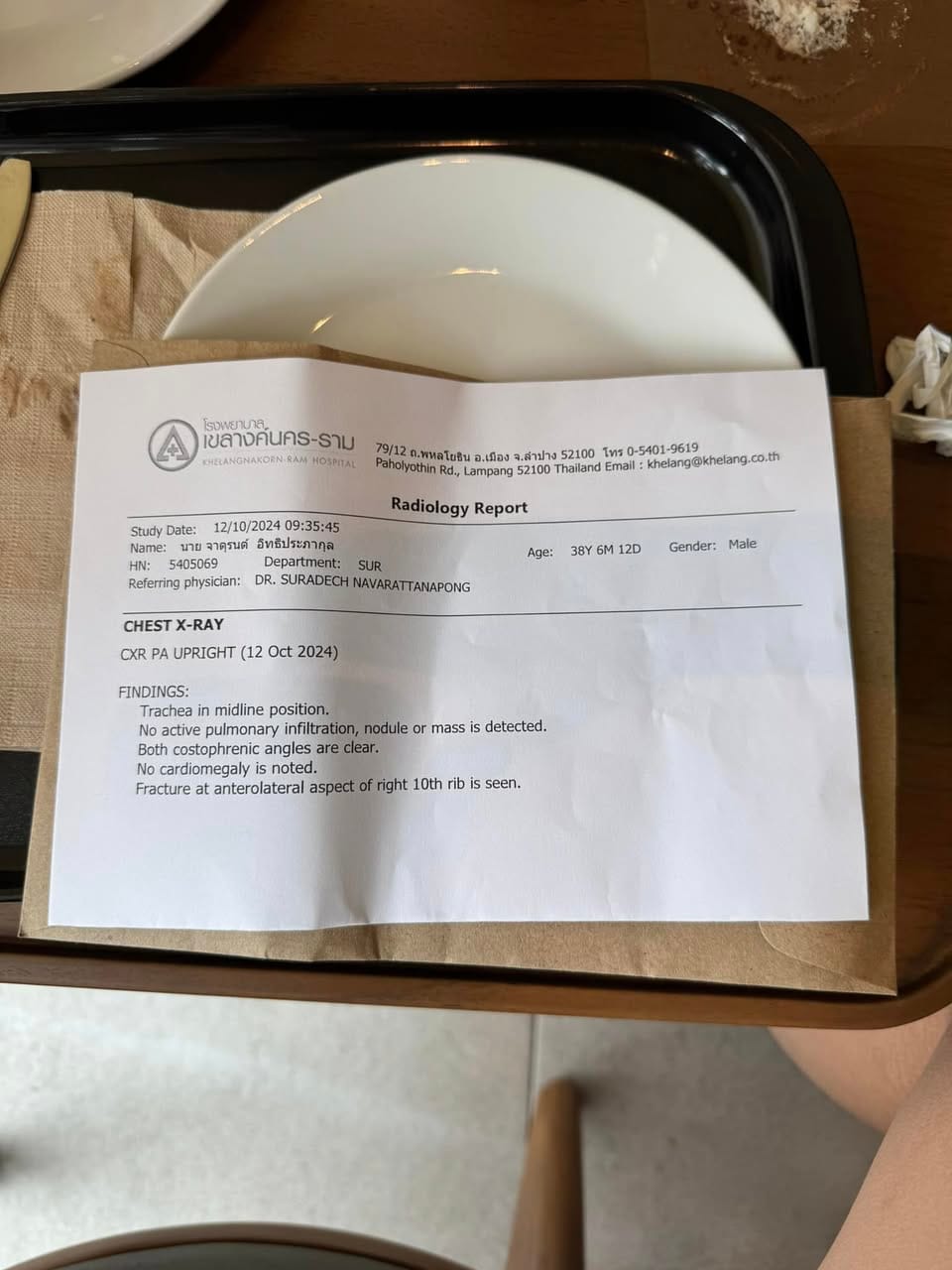 (17/30) กระดูกซี่โครงหัก ครั้งแรกในชีวิต 🩻🦴